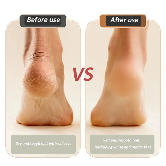 Electric Foot Grinder – Salon-Quality Pedicure at Home
