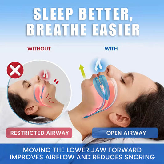 Anti-Snoring Mouthpiece