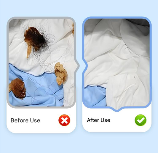 LintAway™ Reusable Washing Machine Filter